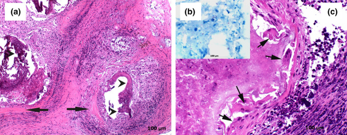 FIGURE 3