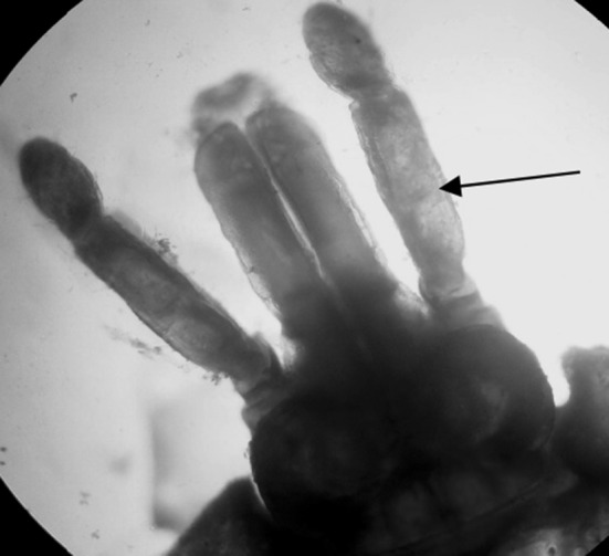 Fig. 1