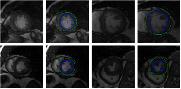 Figure 21