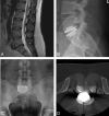 Fig 4.