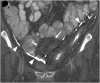 Figure 11.
