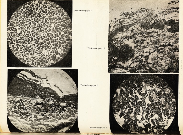 Photomicrograph 5. Photomicrograph 6. Photomicrograph 7. Photomicrograph 8.