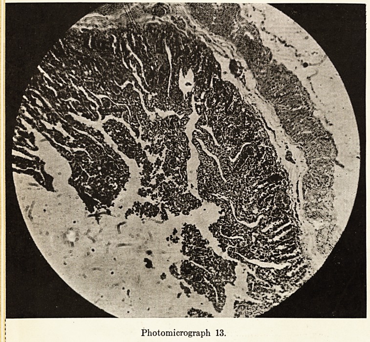 Photomicrograph 13.