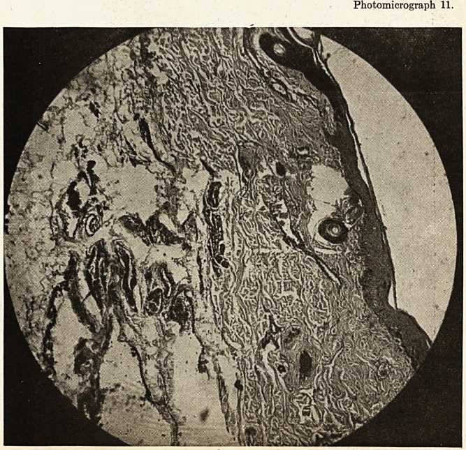 Photomicrograph 11.