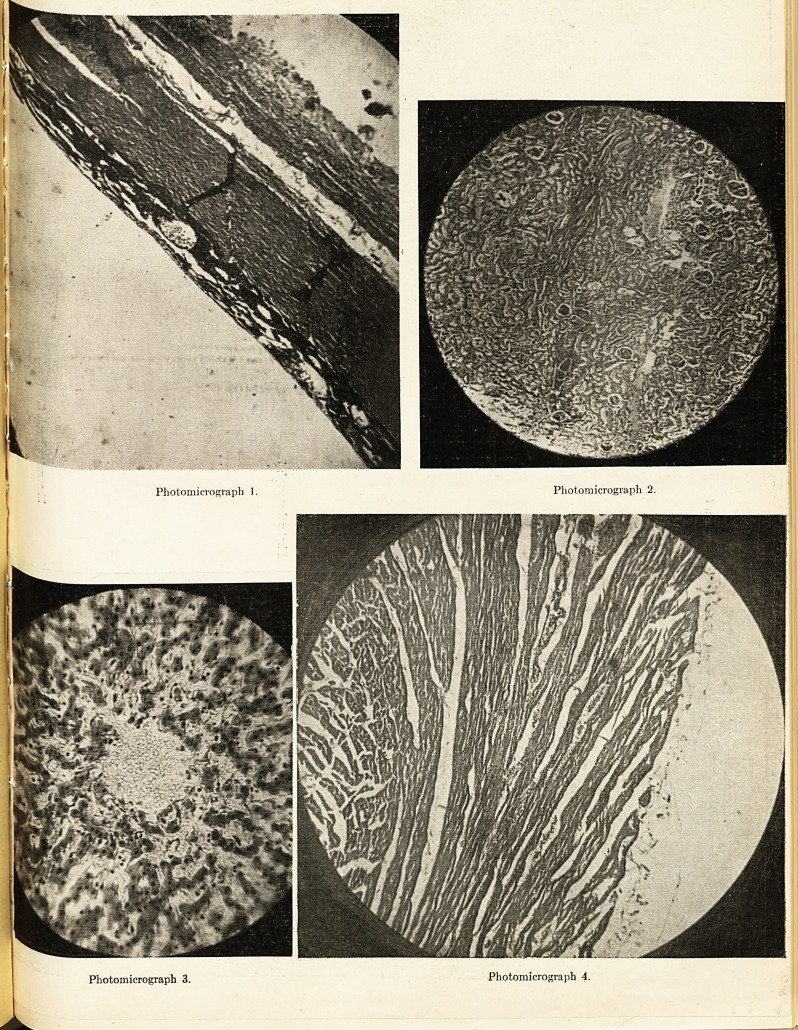 Photomicrograph 1. Photomicrograph 2. Photomicrograph 3. Photomicrograph 4.