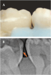 Fig. 4