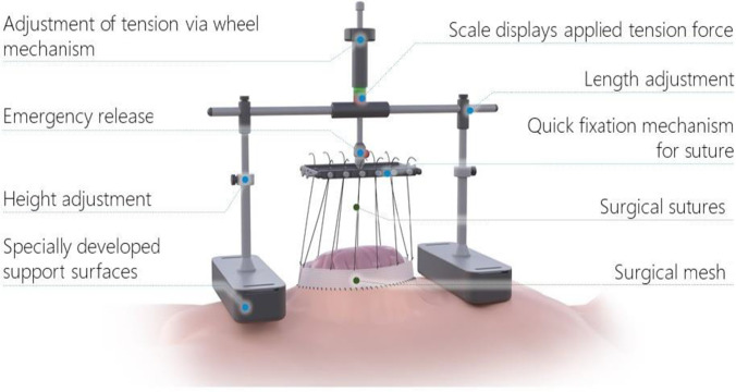 Fig. 1