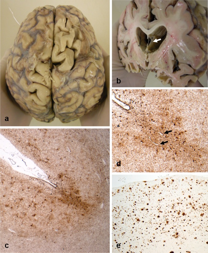 Fig. 1