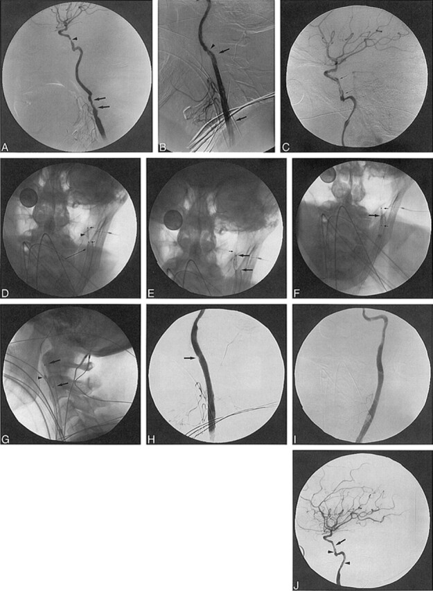 fig 2.