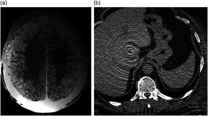 Fig. 9