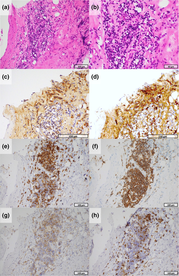 FIGURE 2