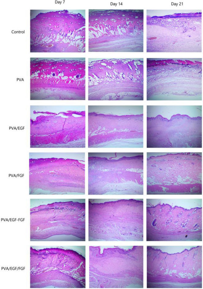 Figure 11