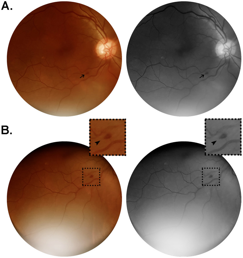 Fig 2