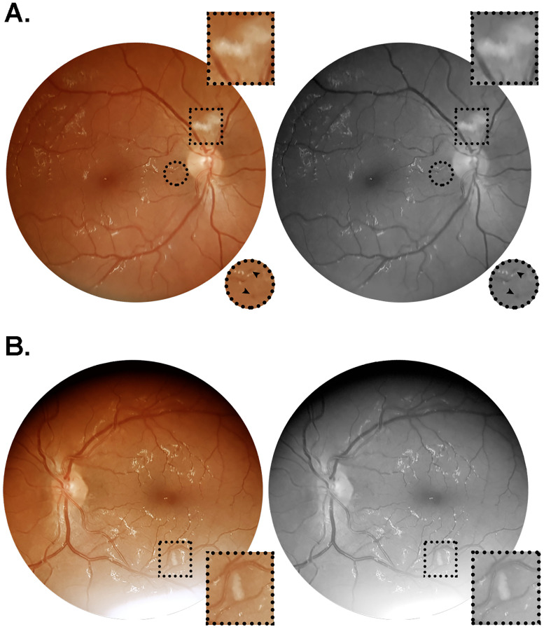 Fig 1