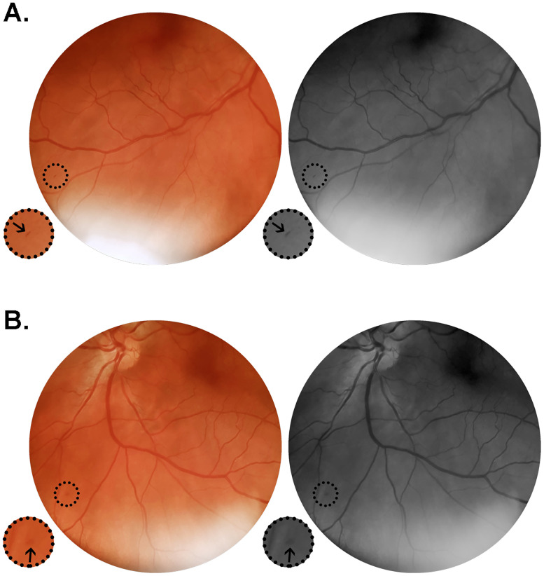 Fig 3