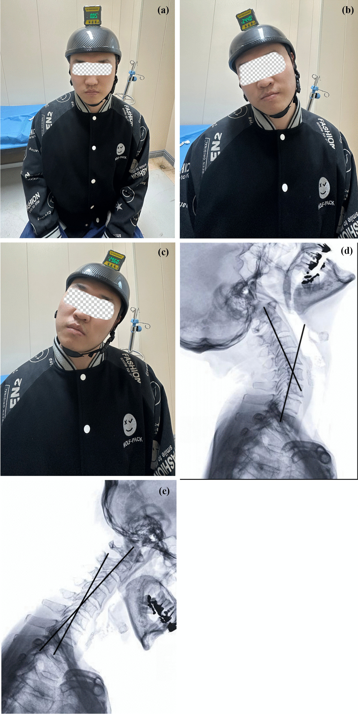 Fig. 3