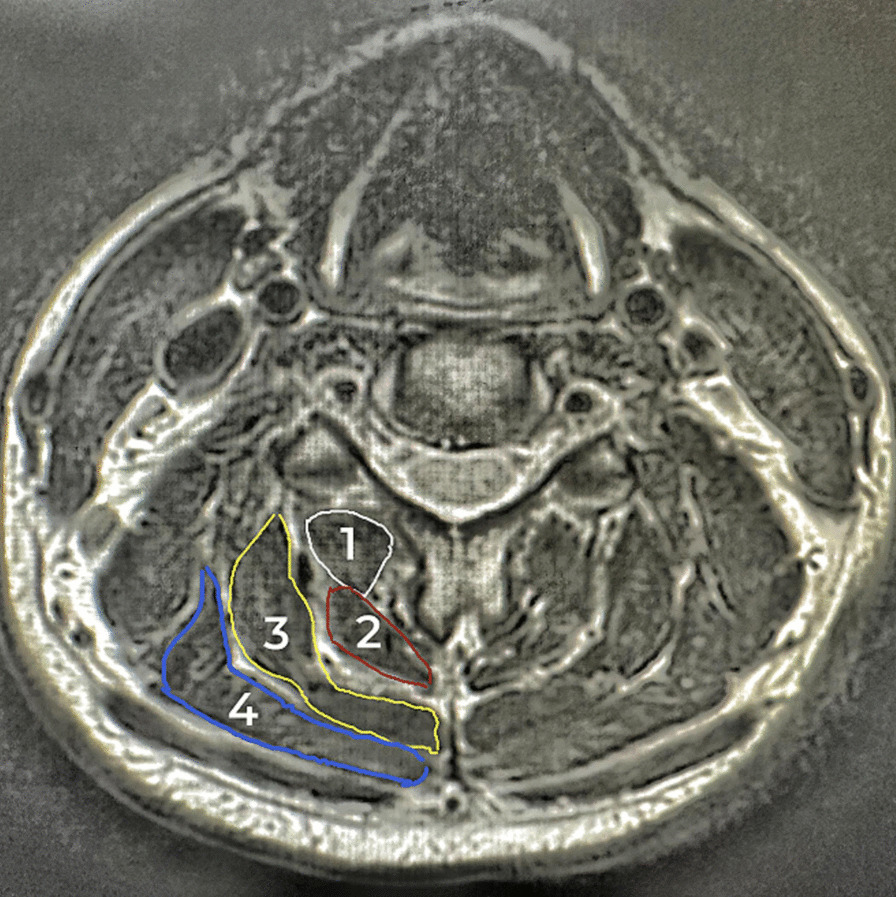 Fig. 4
