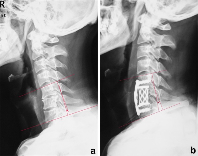 Fig. 3