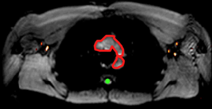 Figure 2e: