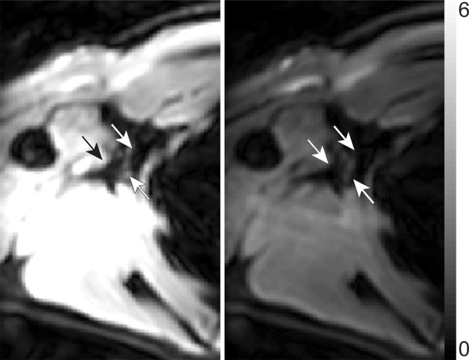 Figure 1d: