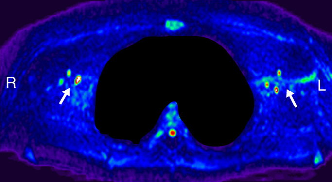 Figure 2c: