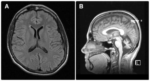 FIGURE 1