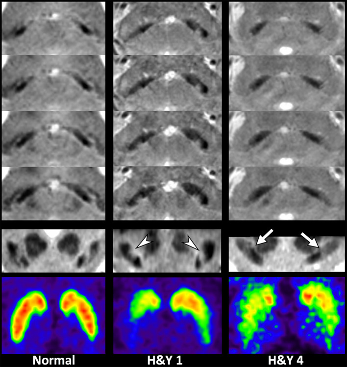 Figure 11.