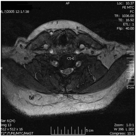 Fig 3