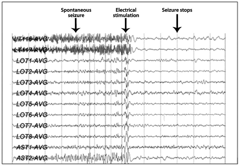 Figure 10-2