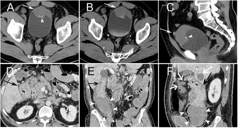 Fig 2