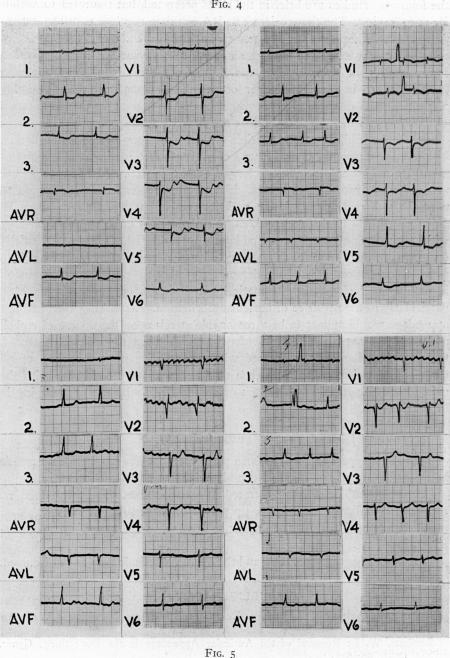 Fig. 4., Fig. 5.