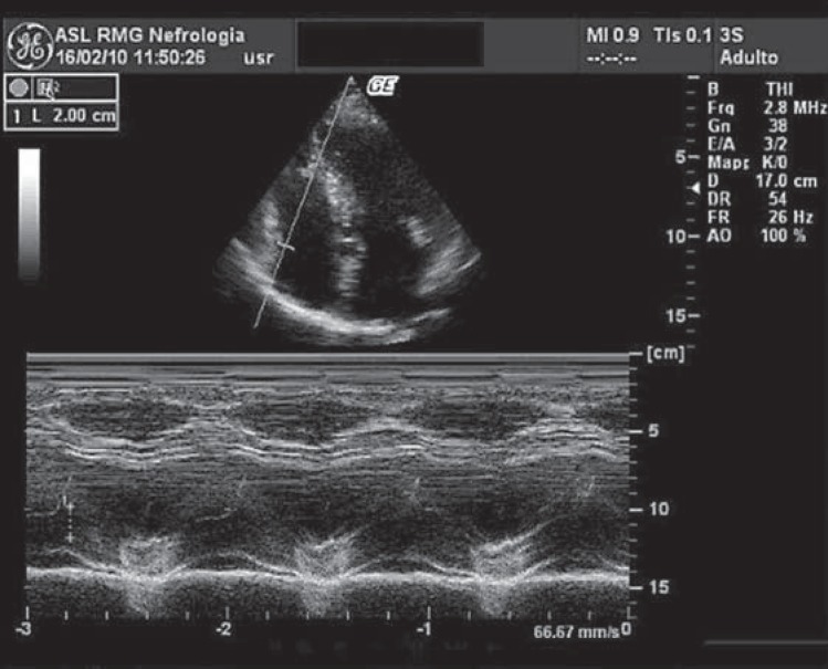 Fig. 1