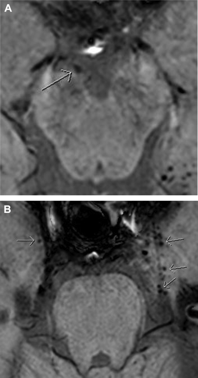 Fig. 4