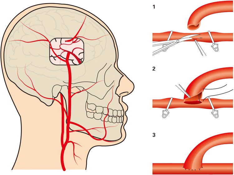 Figure 4.