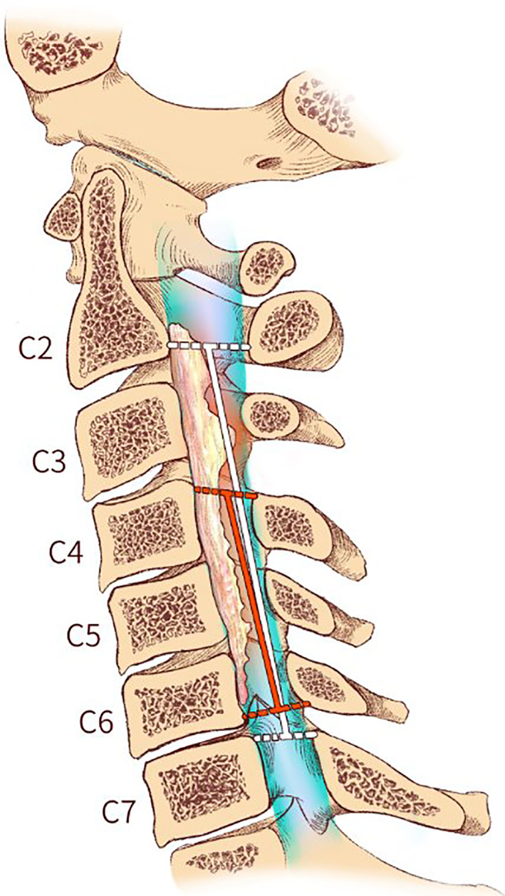 FIG 1