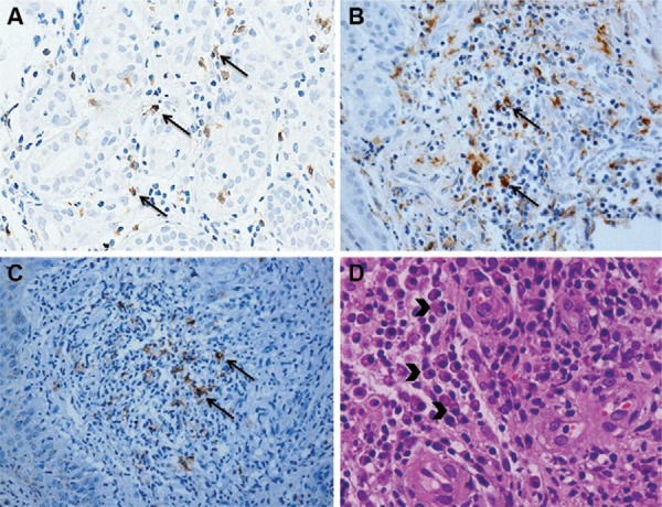 Fig. 2A