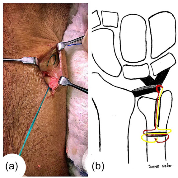 Figure 2.