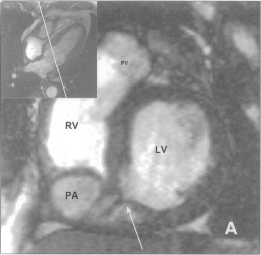 Figure 1A