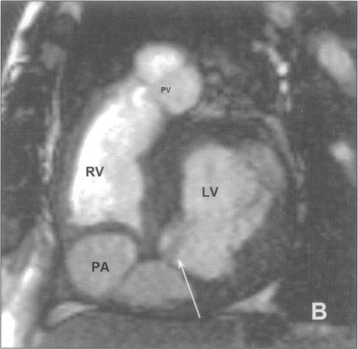 Figure 1B