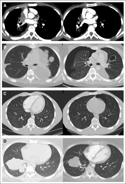 Fig 3.