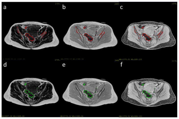 Figure 15