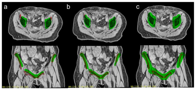 Figure 14