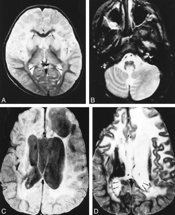 fig 2.