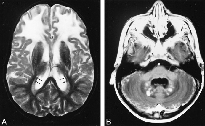 fig 6.