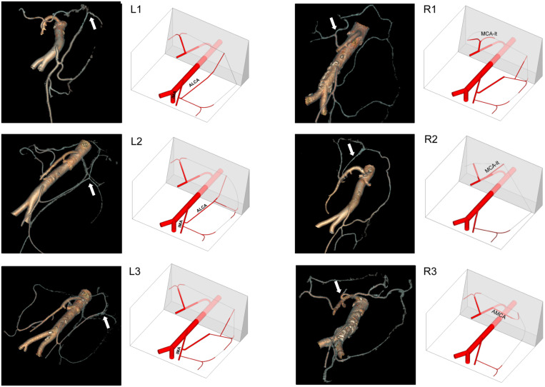 FIGURE 4