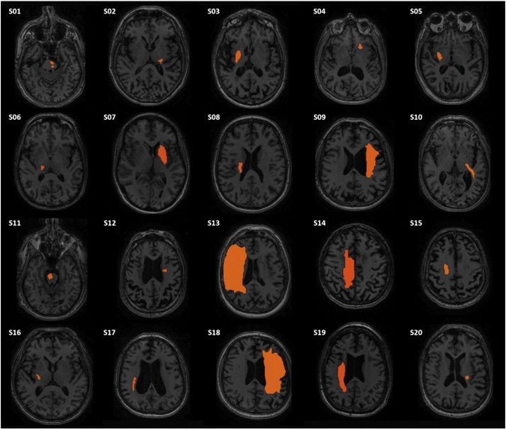 Fig. 1