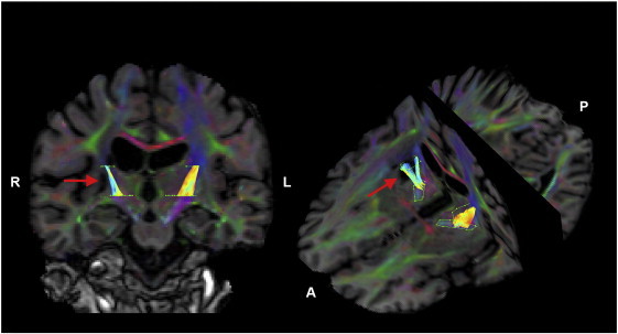 Fig. 4