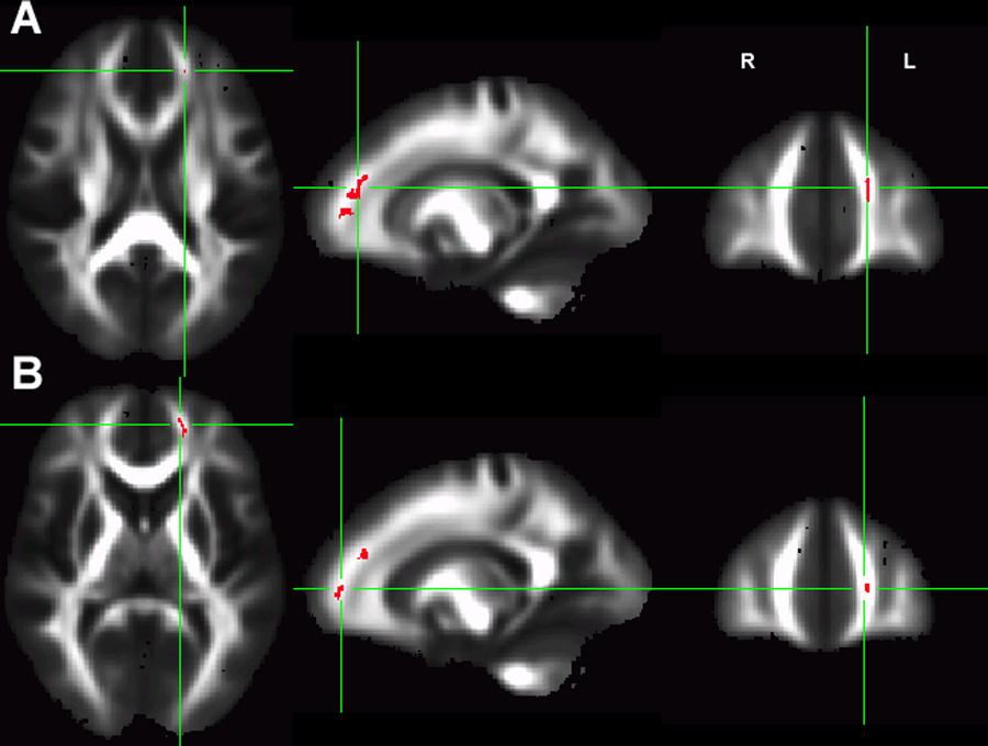 Figure 3: