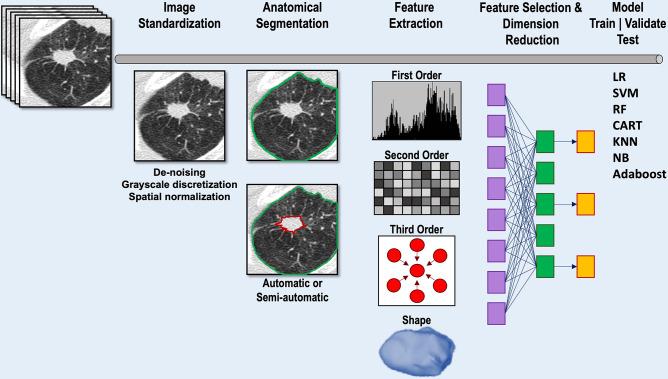 Diagram shows image analysis pipeline for conventional radiomic feature extraction and model development. Following input of the CT scan, image standardization may be performed to reduce image heterogeneity. Segmentation of the lung and nodule of interest can be performed automatically, semiautomatically, or manually. Following segmentation, radiomic features are extracted. Feature selection methods are applied to reduce the number of features while retaining as much feature variation as possible. The optimal radiomic features can then be input into one of a number of different machine learning models to train and validate the model. Model testing uses cross-validation, an internal subset of the data that has been set aside, or an external data set unrelated to the training data set. CART = classification and regression tree, KNN = k-nearest neighbor, LR = logistic regression, NB = naive Bayes, RF = random forest, SVM = support vector machine.