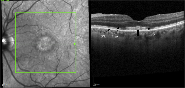 Fig. 3B